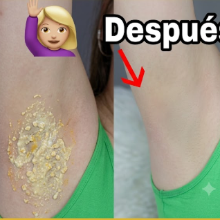 🪞 Las 4 soluciones reales y caseras para blanquear las axilas rápido